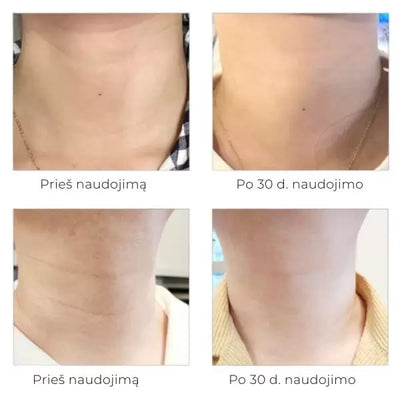 Arocell Super Neck Cream intensyvaus poveikio kaklo kremas 80g