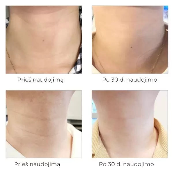 Arocell Super Neck Cream intensyvaus poveikio kaklo kremas 80g