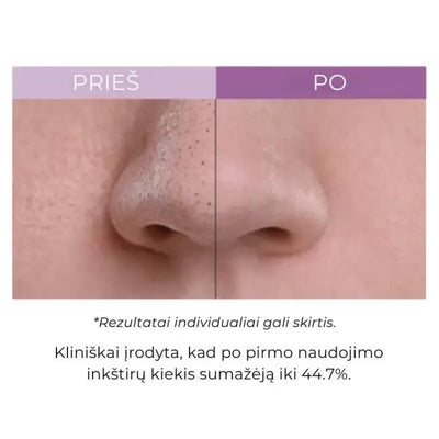 Arocell Super Collagen Melting Cleansing Balm valomasis balzamas 100g