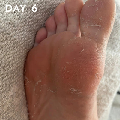 +maskology FOOT PEEL Professional Foot Treatment Nulupamoji pėdų kaukė-kojinės, 1 pora