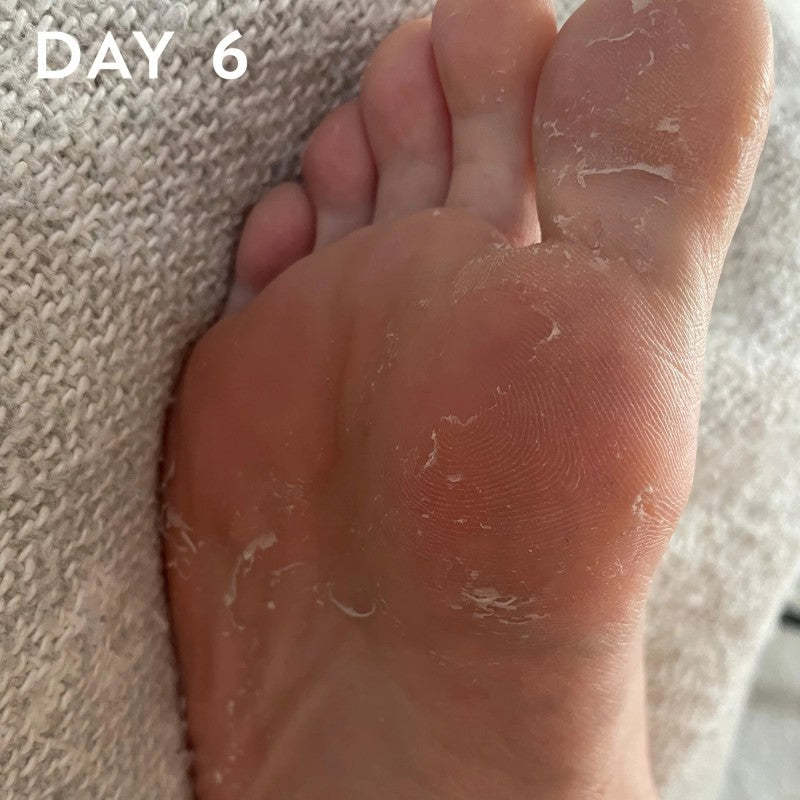 +maskology FOOT PEEL Professional Foot Treatment Nulupamoji pėdų kaukė-kojinės, 1 pora