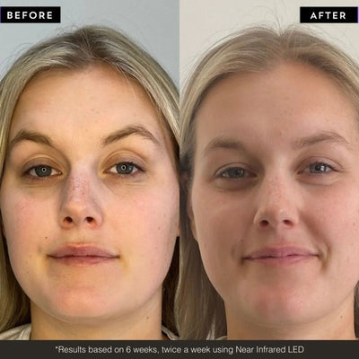 +maskology PHOTON LED Light Therapy Face Mask LED veido kaukė, 1vnt