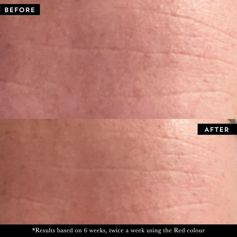 +maskology PHOTON LED Light Therapy Face Mask LED veido kaukė, 1vnt