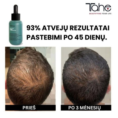 Plaukų slinkimą mažinantis ir augimą skatinantis koncentratas Peptide T98 TAHE, 50 ml