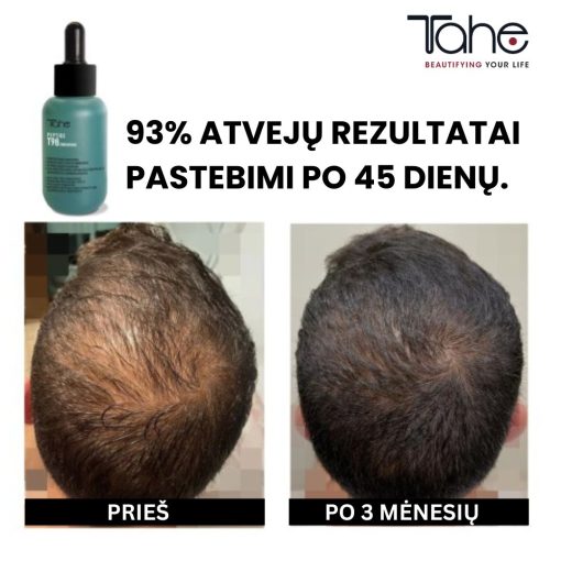 Peptide T98 TAHE hair loss-reducing and growth-stimulating concentrate, 50 ml
