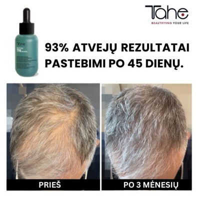 Peptide T98 TAHE hair loss-reducing and growth-stimulating concentrate, 50 ml