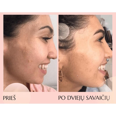 FLOREVE (IN) DETOX натуральная пищевая добавка для очищения кожи