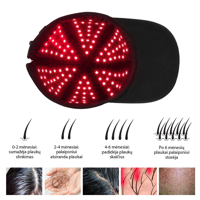 Hair cap Be OSOM Red Light Therapy Cap Black, BEOSOMREDLIGHTCAP, which promotes hair growth