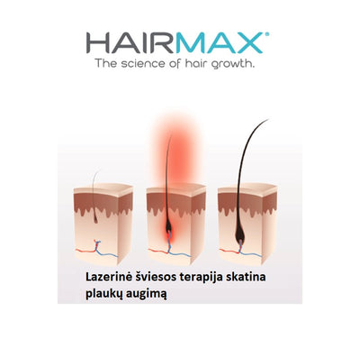 Lazerinė kepuraitė plaukams HairMax Laser Cap 272, LASERCAP, skatina plaukų augimą