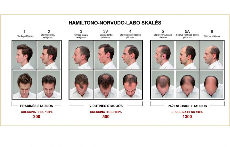 CRESCINA TRANSDERMIC RE-GROWTH HFSC 100% ампулы для восстановления роста волос ДЛЯ МУЖЧИН, сила 1300, 20 шт. + шампунь для волос в подарок